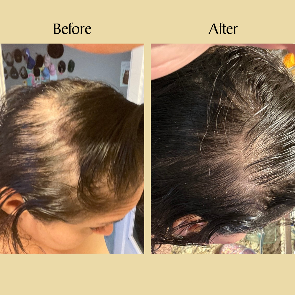 Labor Day Sale - Veganic Natural Hair Growth Oil